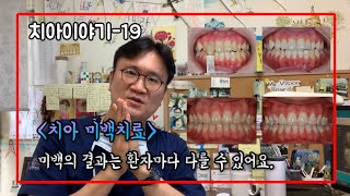 [치아이야기-19] 치아미백치료. 미백의 결과는 환자마…