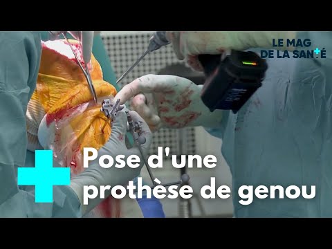 Vidéo: 3 façons de dormir après une arthroplastie du genou