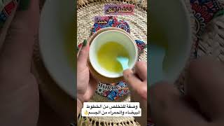 وصفة للتخلص من الخطوط البيضاء والحمراء بالجسم