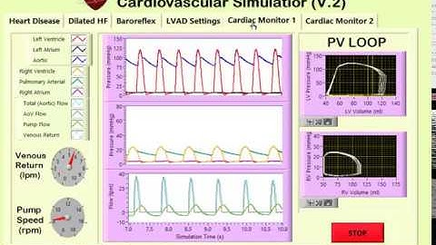 Cardiovascular Simulator Mechanically Assisted Circulation