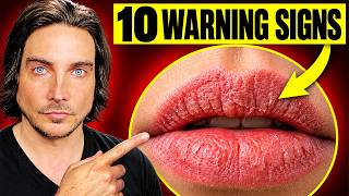 10 Signs Your Body Is Nutrient Deficient βAnd How To Fix It!
Your body may already be showing signs of nutrient deficienciesβand ignoring them could allow your health to decline further. These 10 warning signs reveal what your body may be missing and why correcting the problem matters.
Fresh, whole foods can provide essential nutrients, while an unbalanced diet may leave critical nutritional gaps. Watch this video to recognize the signs, understand what they could be telling you, and learn how to start addressing the problem. Click here to watch:
0:00 lIntro
2:37 1. Cysts
4:04 2. Psoriasis
4:52 3. Thyroid
5:40 4. Diverticulitis
6:22 5. SIBO
7:28 6. Candida
8:21 7. Fungus
9:02 8. Dandruff
9:35 9. Thinning Hair
10:29 10. Arthritis
11:04 Get Support
16:18 Summary
Work With Me:
Raw Vegan Mentor
Mindset Coach
Intuitive Detox Specialist
https://www.rawveganrising.com/workwithme
πππππ
FREE VIDEO COURSE
How To Go Raw Vegan: Start Here Guide
https://www.rawveganrising.com/starthere
πππππ
Raw Vegan Heroes Membership
75% Off For A Limited Time
https://www.rawveganrising.com/offers/6zrzFTLz/checkout?coupon_code=YEARLY75
πJoin My Text Community For Personalized Tips And Support On Your Raw Journey. Text HERO to 1-512-488-3623
https://my.community.com/shanesterling?t=HERO
For More Content Follow:
TikTok:
https://tiktok.com/@rawveganrising
Instagram:
https://www.instagram.com/rawveganrising
Facebook:
https://www.facebook.com/rawveganrising2
#rawvegan #healing #experience 10 Signs Your Body Is Nutrient Deficient βAnd How To Fix It!