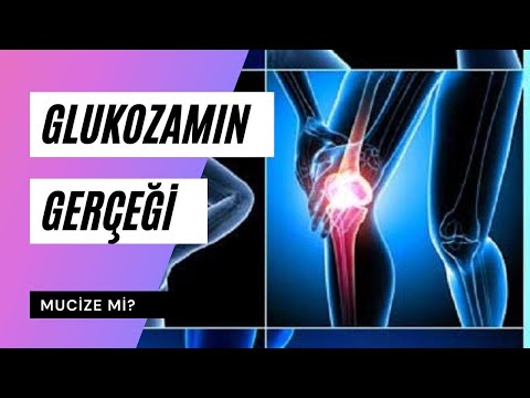 Bunu Biliyor Muydunuz ? Glukozamin Mucize midir ?