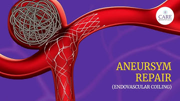 Aneurysm Repair -  Endovascular Coiling | CARE Hospitals