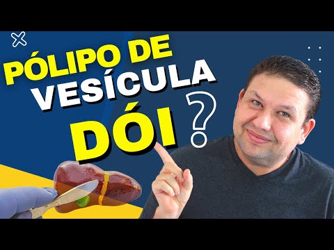 Vídeo: Vesícula incomum e não caprichosa 