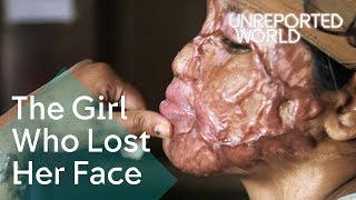 Download Lagu Bangladesh acid attack survivors helping each other heal | Unreported World MP3