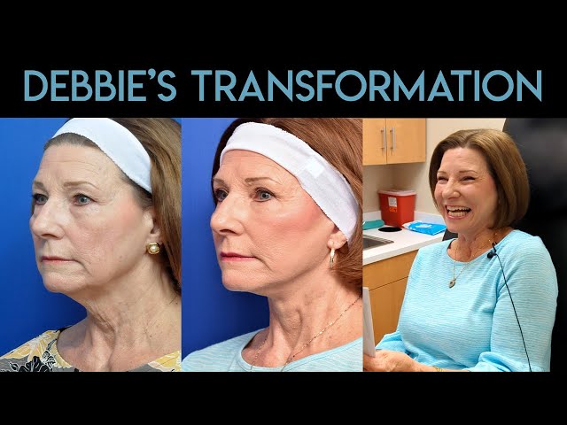 Debbie's Transformation