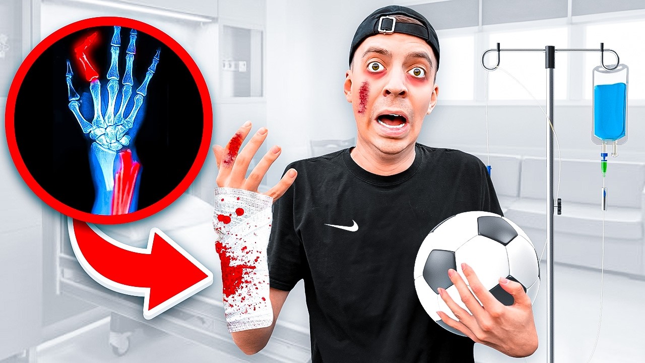HAND GEBROCHEN wegen FUSSBALL CHALLENGE... 😰🚑 (Krankenhaus)