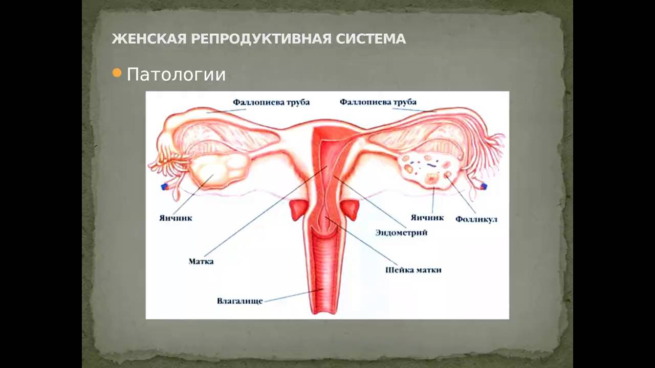 ���������� ��������� ���� ����� #13