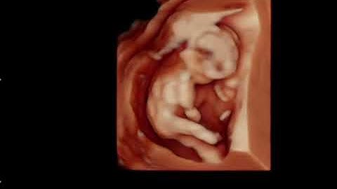 Hình ảnh siêu âm như thế nào là con trai