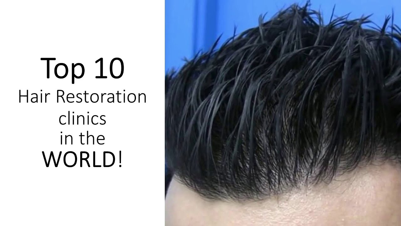 Top Hair Transplant Clinics In Turkey - Birmingham Times