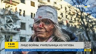 Лицо войны: украинка пережила взрыв российского снаряда
