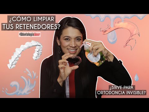 Vídeo: Cómo Limpiar Los Retenedores: Consejos Y Trucos