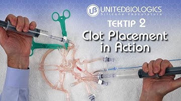 TekTip no.2 Clot Placement In Action