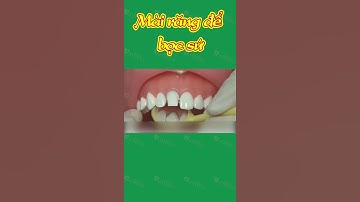 [3D] MÀI RĂNG ĐỂ BỌC SỨ || Nha Khoa Quốc Tế Athena