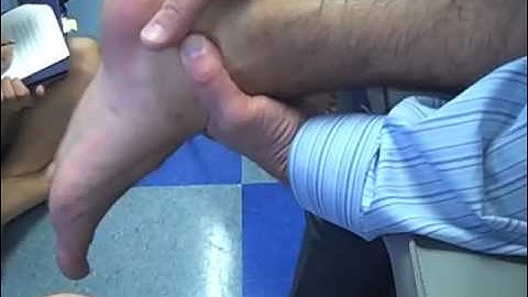 SUB TALAR JOINT DISTRACTION