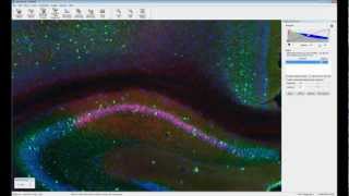 Whole slide imaging - Overview