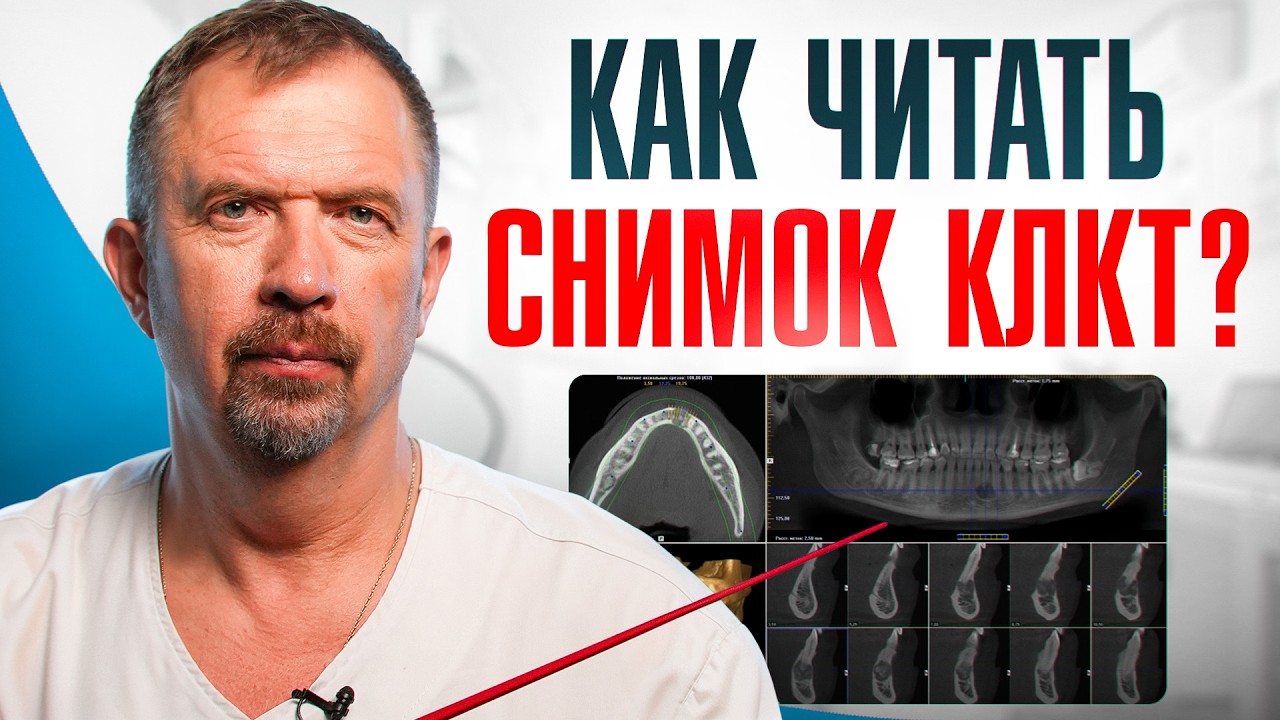 Как интерпретировать КТ ВНЧС: СЕКРЕТЫ ТОЧНОЙ ДИАГНОСТИКИ!