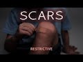 Scars restrictive 01212024 1st service