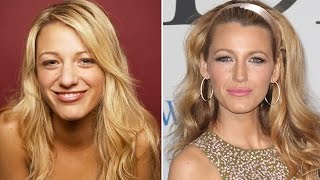 Celebrity Blake Lively Plastic Surgery Profile
