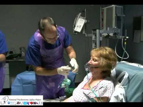 Decannulation of tracheostomy tube narrated