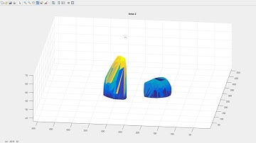 Lung Tumor Through Breathing Cycle from CT Images