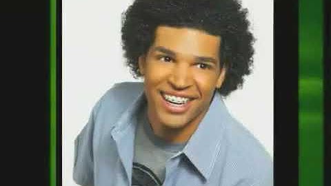 Mắc cài Smart Clip Self ligating braces