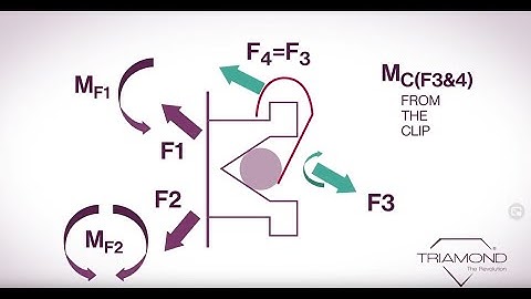 Triamond Wedgewise Biomechanics