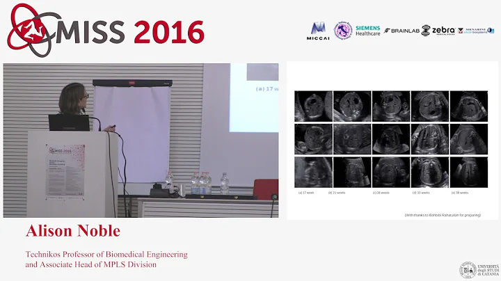 Alison Noble - Learning to interpret Ultrasound Im...