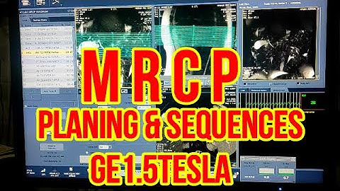 MRCP Bile Ducts MRI scan Protocol, Positioning & Planning | Live MRCP Education.