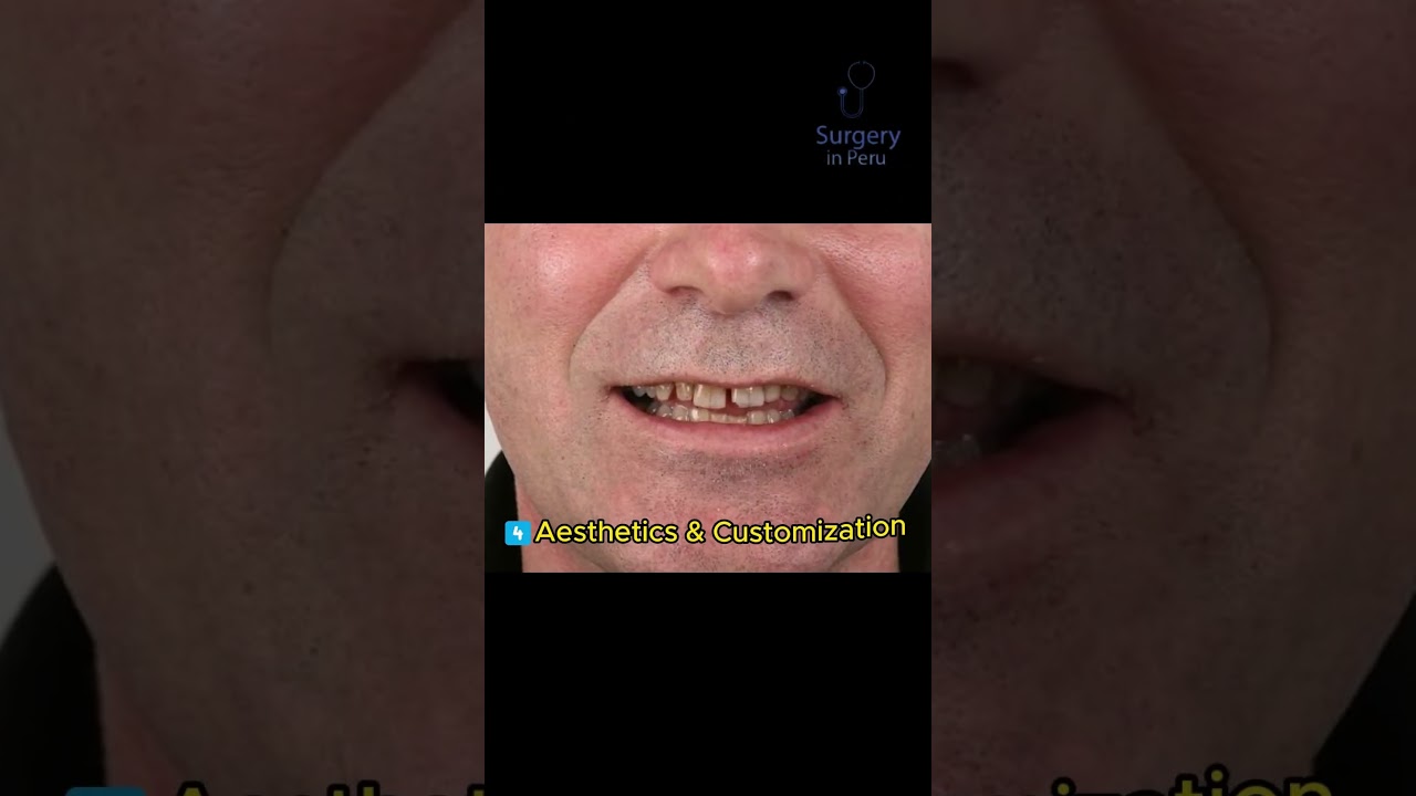 CEREC video Crowns and Veneers in Lima, Peru