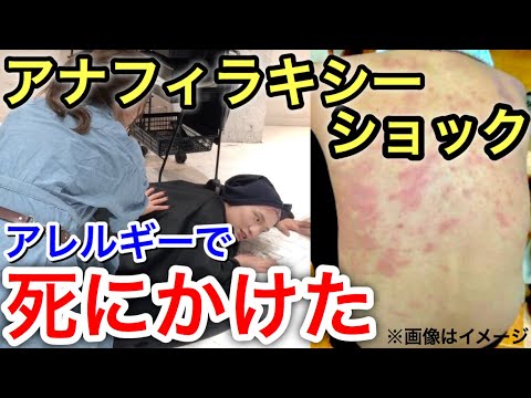 【危険】美容室でブリーチアレルギーで倒れて死にかけた話