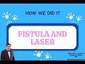 LASER FISTULA SURGERY- QUICK AND EASY - लेज़र फिस्टुला सर्जरी - तेज़ और आसान