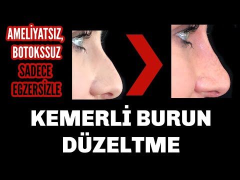 Kemerli Burun Düzeltme Egzersizleri | Nose Exercise