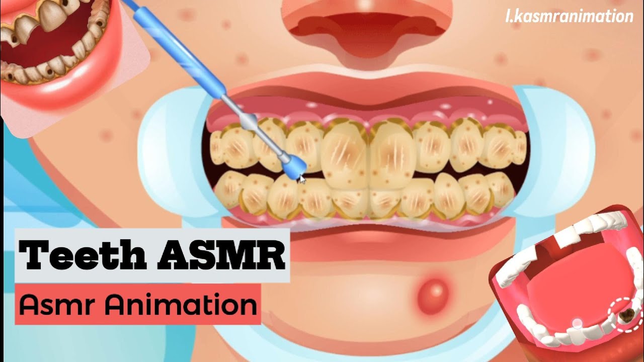 ASMR Teeth repairing and cleaning treatment compilations #asmr #animation