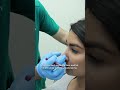 Pulse Light Clinic: Sallyha's Experience