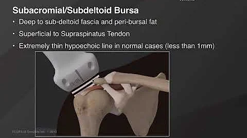 Webinar: Ultrasound-Guided Shoulder Injections Part 2