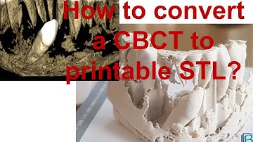 How to convert a CBCT DICOM to a printable STL file for free?