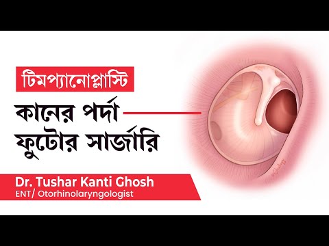 ভিডিও: একটি ওয়েল পর্দা প্রতিস্থাপন করা যেতে পারে?