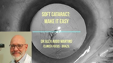 SOFT CATARACT: MAKE IT EASY