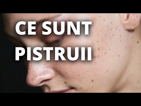 Video: 3 moduri de a evidenția pistruii naturali