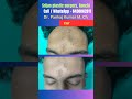 scar revision surgery| Result of scar revision surgery| Best scar treatment in India