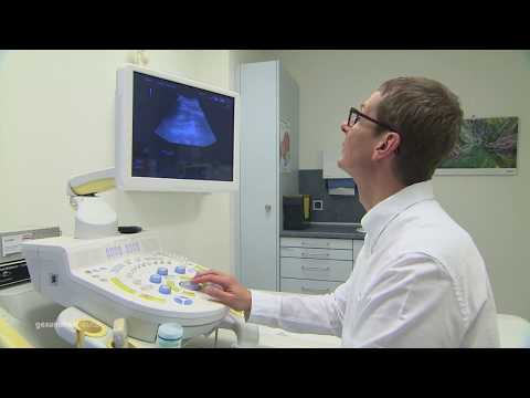 Video: Normale Spermienzahl: Verständnis Ihrer Samenanalyse