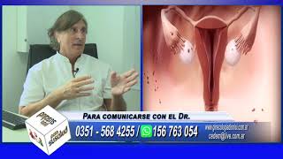 Tratamiento para la endometriosis   Dr  Humberto Dionisi   30 01 2021