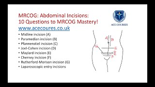 Download Lagu Abdominal incisions for the MRCOG exam. 'MRCOG Mastery in 10 Questions Series' from ACE Courses. MP3