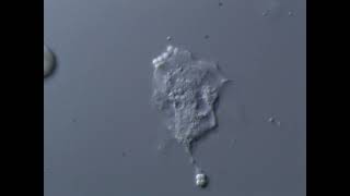 Live Human Blood Cells (erythrocytes and leukocytes). A Neutrophil eating bacteria. DIC Microscopy