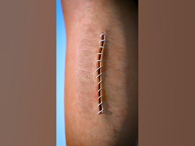 How Stitches Work 😯