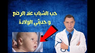 حب الشباب عند الاطفال حديثي الولادة و الرضع