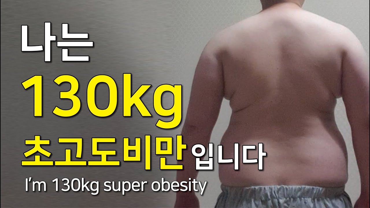나는 130kg 초고도비만 남성입니다.(I'm 130kg super obese man) - YouTube