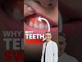 🚨 Don’t Ignore the Swelling | Signs Your Tooth Needs Help 🚨