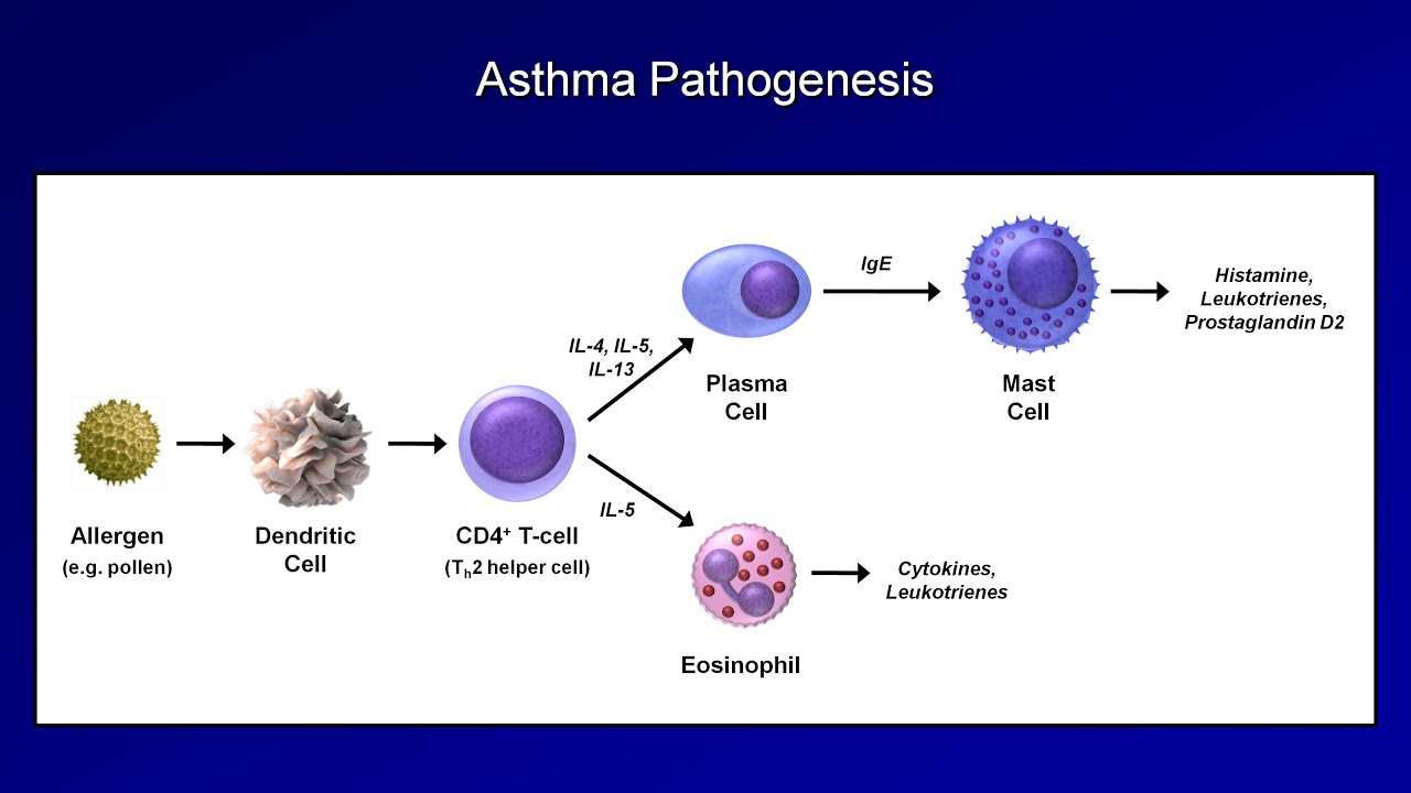 Asthma Pathophysiology Flow Chart